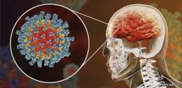 ‎دراسة جديدة تحذر من أضرار دماغية مرتبطة بكوفيد-19