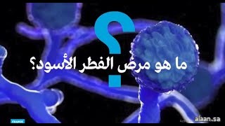 بعد تخطي الأرقام عتبة 7 آلاف إصابة .. ما هو الفطر الأسود القاتل ولماذا انتشر في الهند تحديدا ؟..